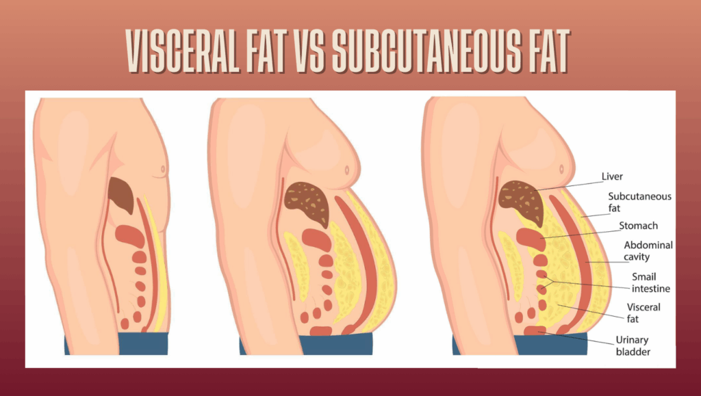 Diagram showing difference between subcutaneous fat and visceral fat in the abdomen